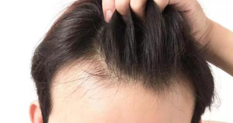 白頭發(fā)越長(zhǎng)越多，你以為是老了？提醒：或是缺乏幾種營(yíng)養(yǎng)素